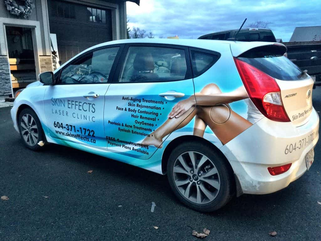 Car wrap for Skin Effects Laser Clinic